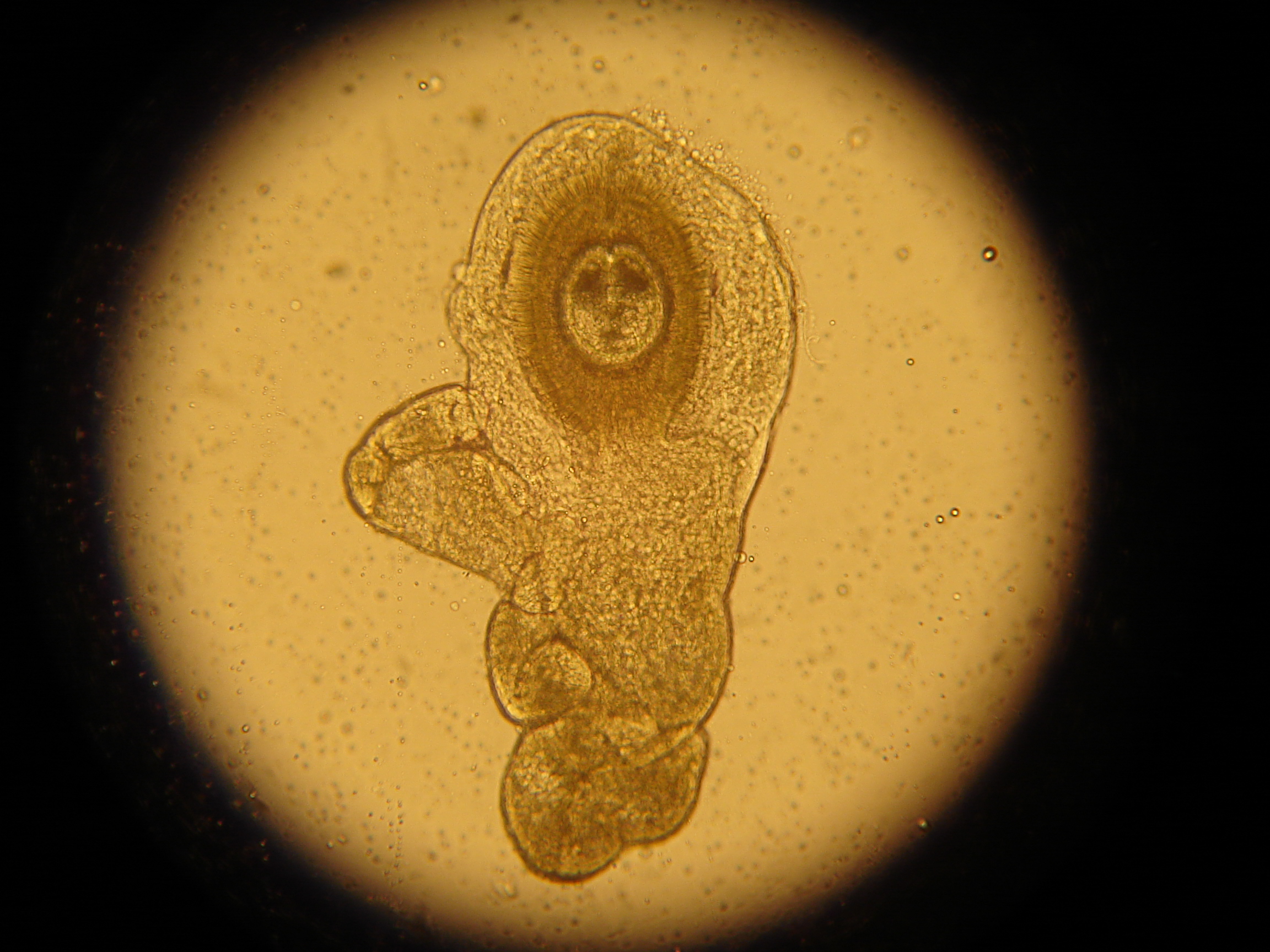 Обида микроскоп. Гименолепис диминута. Hymenolepis diminuta яйца. Яйца гельминтов микроскопия. Hymenolepis diminuta под микроскопом.